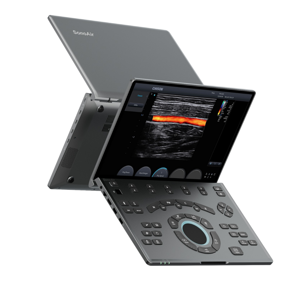 УЗ-изображение на экране CHISON SonoAir